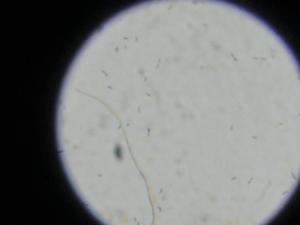 グラム陽性桿菌